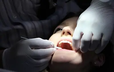 Учени изясниха истинската причина за появата на кариеси