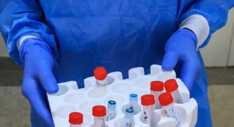 Най-много новозаразени с Covid-19 в Сливен за денонощието