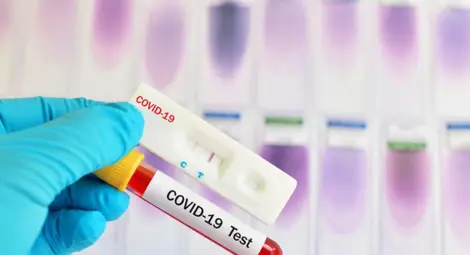 1595 новозаразени с COVID-19, 17,65 % от тестваните; 16 са починали