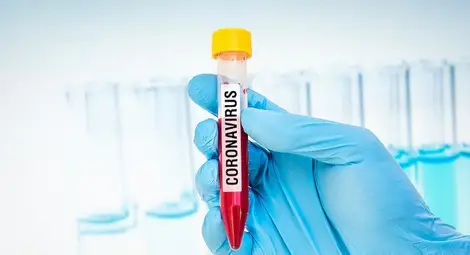 Куриерските фирми отказаха да доставят пробите за коронавирус в София Куриерските фирми отказаха да доставят пробите за коронавирус в София