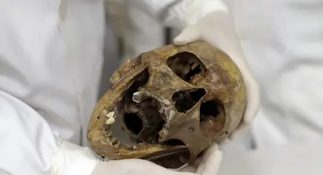 Останките на Менгеле - учебен материал за студенти