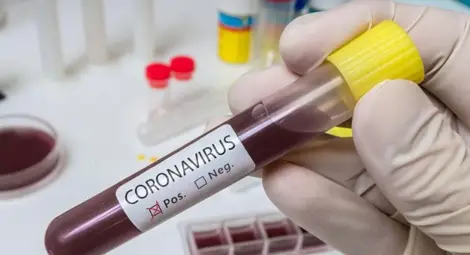 Новите двама заразени с коронавирус се прибрали болни от Англия