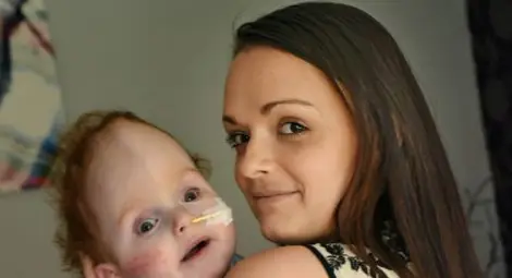 Дете без мозък каза "мама"