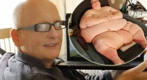 Мъж отслабна с 305 кг заради любовта на живота си