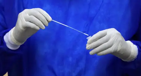 1123 са новите случаи на коронавирус