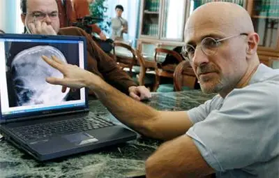 Хирург: До 2 г. ще присадя цяло тяло