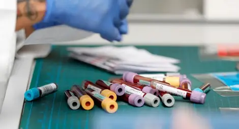 Защо изследване за антитела не е достатъчно за издаване на зелен сертификат?