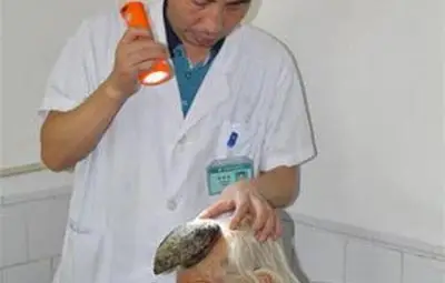 Китайка има 13-сантиметров рог на главата