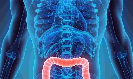 Колит и Синдром на Раздразненото Дебело Черво