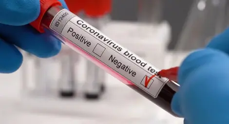 Рекорд: 499 оздравели от Ковид-19 за едно денонощие