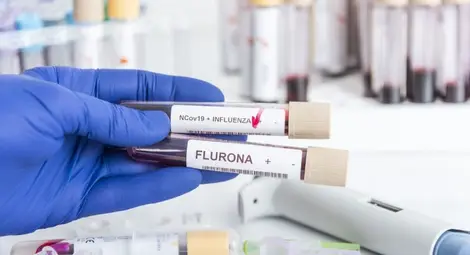 Първи случай в Русе на флурона - коинфекция с грип и коронавирус