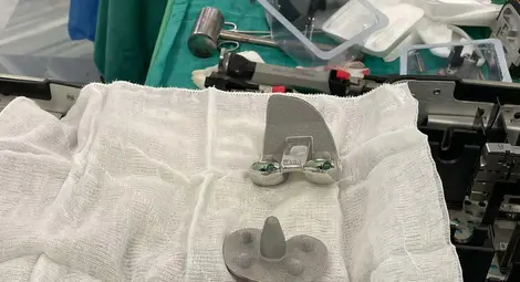 Безциментната протеза