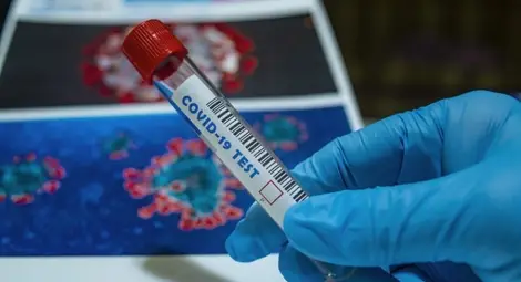 56-годишен учител и още 10 починали носители на Ковид-19 за денонощие в Русенска област