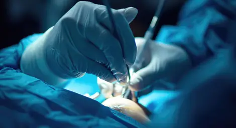 Ортопедите на МЕДИКА оперираха успешно момче с рядка аномалия &bdquo;конско стъпало&ldquo;