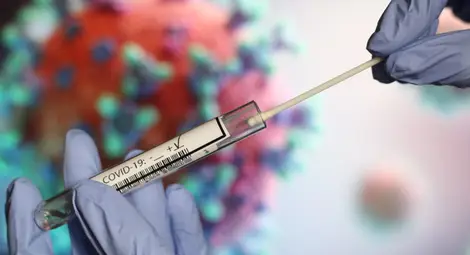 513 нови случая на коронавирус и 43-ма починали