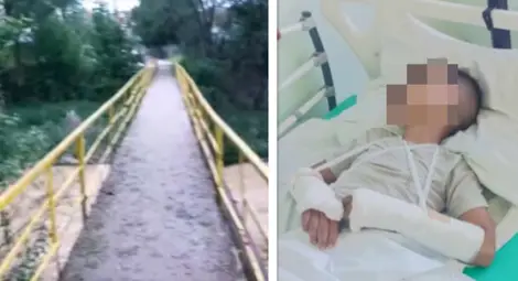 Трагедия в Луковит: 12-годишно момче пребито, бащата твърди, че е хвърлено от мост