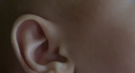 Момче получи уши, които лекарите направили от ребрата му