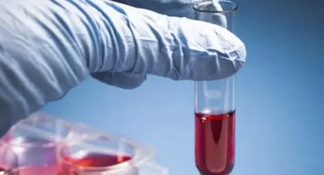 Сензационно откритие! Кръвен тест показва кога ще умрем