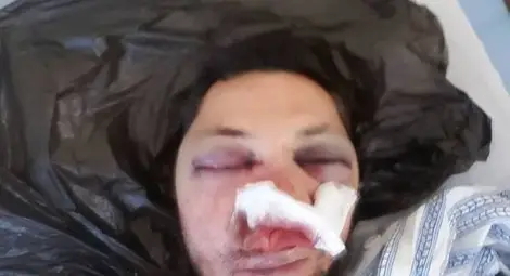 Ново зверство: Пребиха журналист с бухалки!