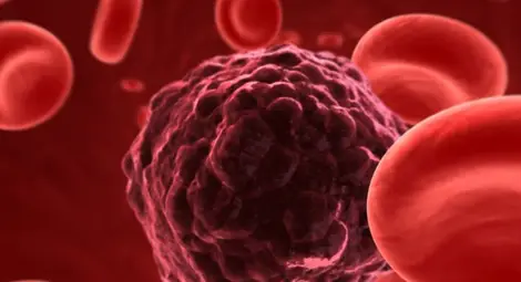 Може ли следенето на ЦТКл (Циркулиращи туморни клетки) да подобри лечението на рак