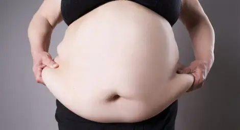 Наднорменото тегло се превръща в глобална епидемия