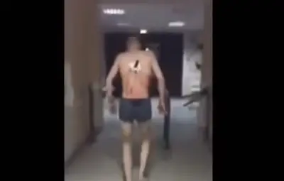 Руснак излиза от болницата да пуши с нож в гърба (Видео)