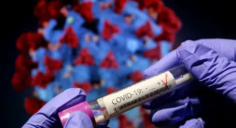 Чехия е на прага на нова вълна от COVID-19 Чехия е на прага на нова вълна от COVID-19