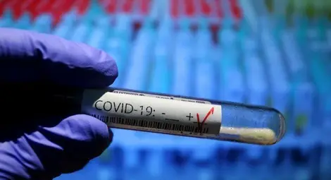 3614 тови случая на коронавирус за деннощие, 130 от тях в Русе и стряскащо  първо място по смъртност в света