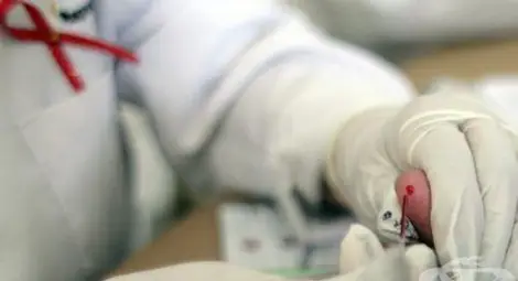 Три нови случая на СПИН в Русе