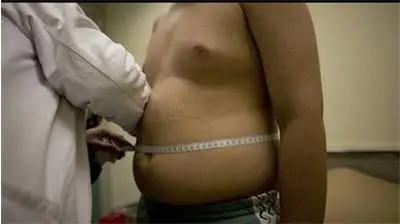 Европа може да признае наднорменото тегло за вид инвалидност