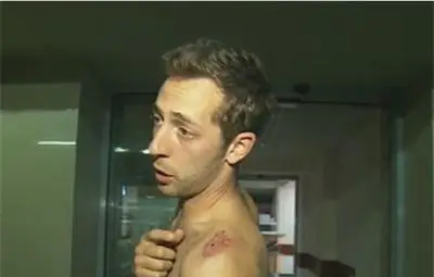 Участник от боя в Орландовци: Роми разцепиха крака на брат ми с брадва