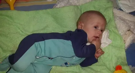 Попариха надеждите за живот на 5-месечния Дилян от Русе! Попариха надеждите за живот на 5-месечния Дилян от Русе!