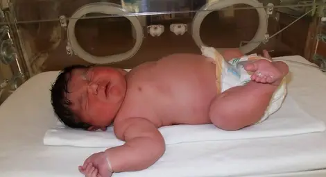 Бебе гигант в Пловдив! Момченце се роди 5,7 кг! Бебе гигант в Пловдив! Момченце се роди 5,7 кг!