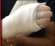 Първо обезщетение за счупена на заледена улица ръка