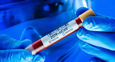 1883 нови случая на COVID-19 - 5,26% от тестваните, 64 души са починали