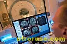 Мигрената може да доведе до трайни изменения на мозъка 