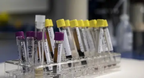 Нови 10 случая на хепатит след взрива в Средна кула