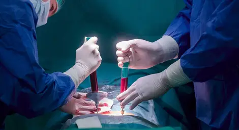 Изкуственият интелект подбира по-добре донорите