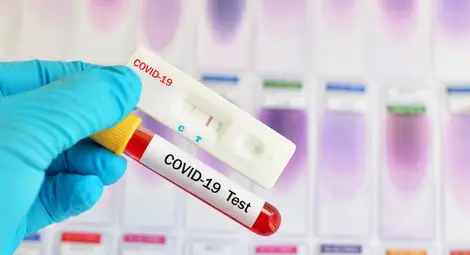 Излекуваните за денонощие пак са повече от заразените