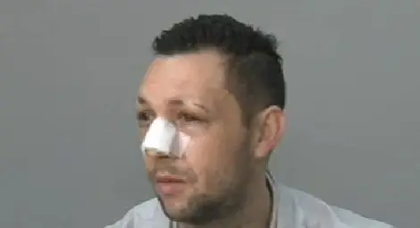 Пребитият журналист Стоян Тончев: Храня се със сламка, поръчаха ме от Община Поморие