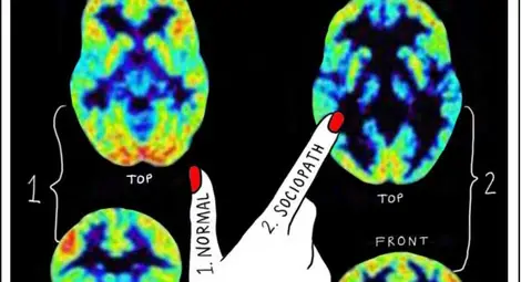 Престъпните наклонности може да се разкрият чрез сканиране на мозъка