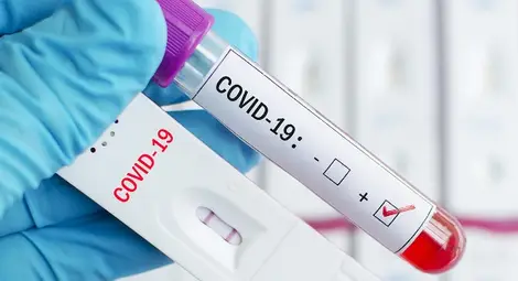 144 нови случая, 27 излекувани и 20 починали за денонощие 144 нови случая, 27 излекувани и 20 починали за денонощие