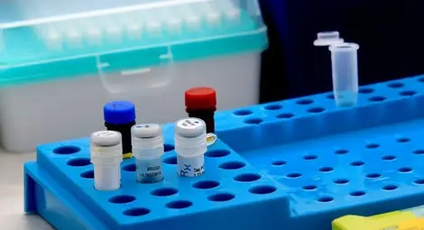 Швейцария изисква отрицателен PCR тест от 8 февруари 2021 г.