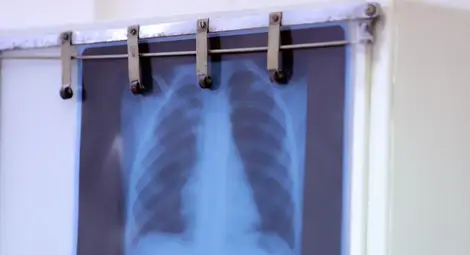 Д-р Гергана Николова: Повишете личната хигиена в борбата срещу вирусите