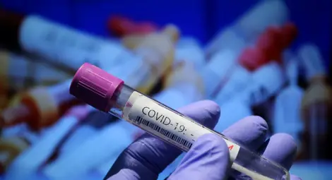 269 нови случаи на коронавирус у нас