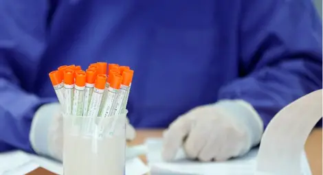 Временно затварят цеха в Доспат, където бяха установени 48 работници с Covid-19