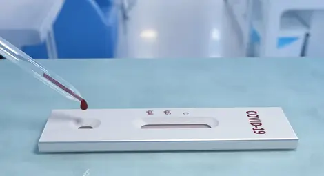 Нов бърз тест за коронавирус премина успешно клинични изпитания Нов бърз тест за коронавирус премина успешно клинични изпитания