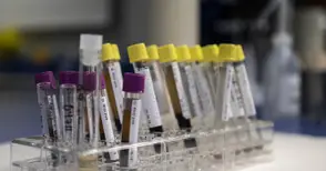 Нови 10 случая на хепатит след взрива в Средна кула