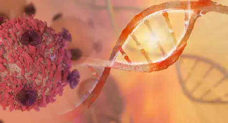 Учени напълно излекуваха жена от терминален рак на гърдата с иновативно лечение Учени напълно излекуваха жена от терминален рак на гърдата с иновативно лечение