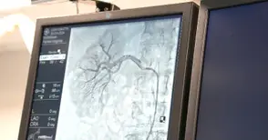 В „Медика“ лекуват по нов начин високо кръвно, което не се влияе от лекарства